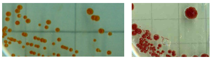Diversité morphologique des bactéries PAA 